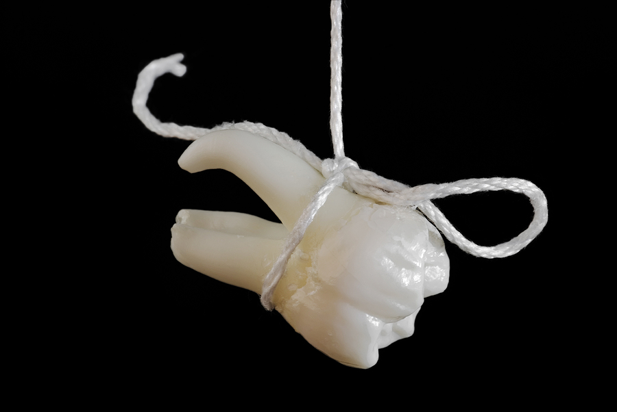 What to Expect Before, During, and After a Tooth Extraction in Jacksonville Beach, FL