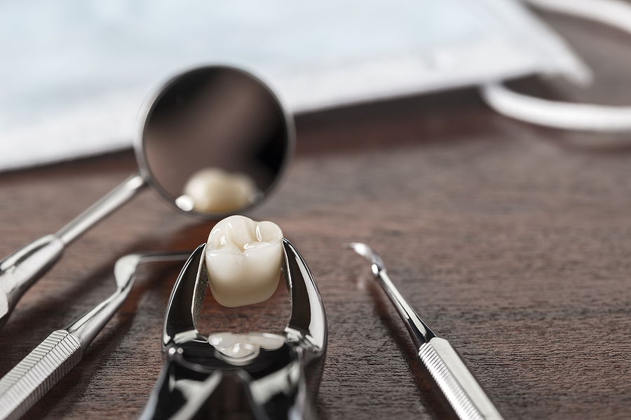 A Comprehensive Guide to Dental Extractions: What You Need to Know