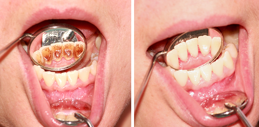 Understanding Oral Pathology: Signs, Diagnosis, and Treatment